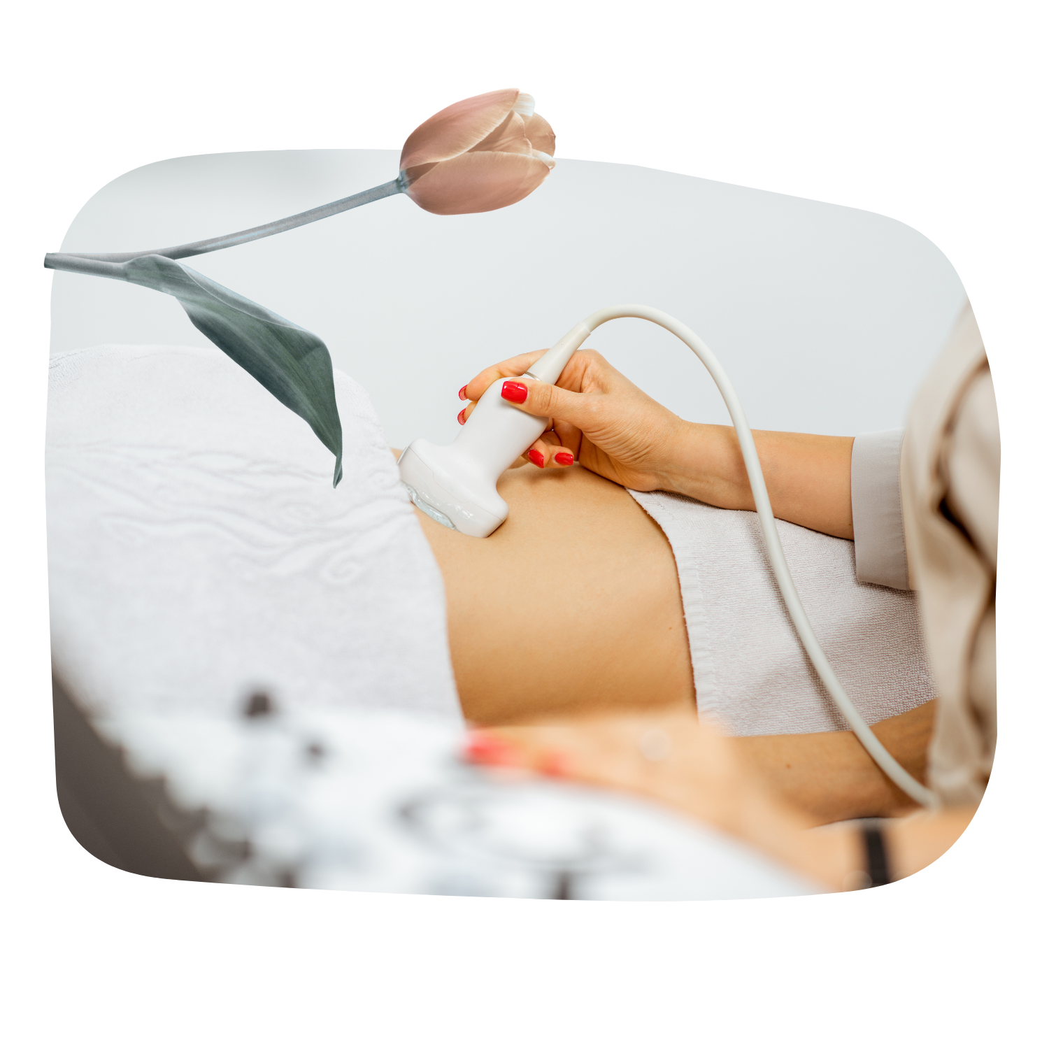 Ultrasound photo 1 CC